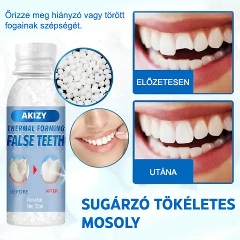 Tooth Repair Kit™ | Szerezze vissza mosolyát (2+2 INGYENES)